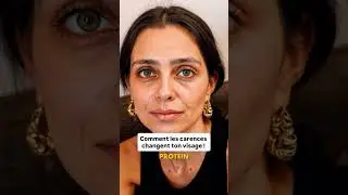 Les carences c&rsquo;est tr&egrave;s fr&eacute;quent chez beaucoup d&rsquo;entre nous 😅 Votre peau, elle, r&eacute;clame un combo