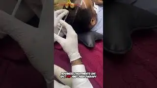 Treatment for Male Pattern Baldness at Dr Adityan Hair and Laser&nbsp;Clinic