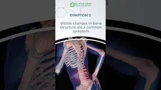 Are you ignoring the symptoms of bone deformity? 🚨 Early diagnosis can make all the difference!