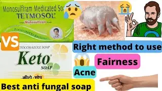 Tetmosol soap review |Keto soap uses in hindi|Best antifungal soap|