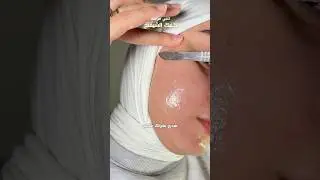 بعد ٨ سنين شيفنج فدي كل تريكاتي لازاله شعر الوجه من غير مايطلع حبوب ✨