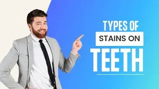 Understanding the Different Types of Dental Stains and How to Remove Them