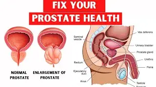 Yoga For Prostate Problems| Best Exercise For Enlarged Prostate