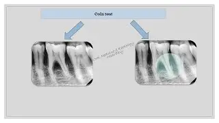 COIN TEST #penny test #dental #bds #mds #oral radiology #radiology #dental video #coin #penny #test