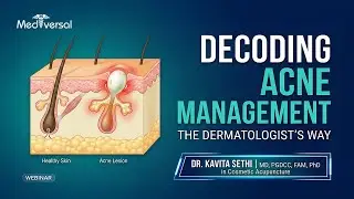 Decoding Acne Management The Dermatologist's Way | Mediversal Academy