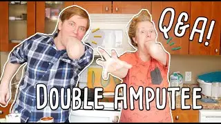 TWO LEFT-HAND CONGENITAL AMPUTEES: STUMP CHATS!