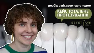Кейс Тотальне протезування (розбір з лікарем-ортопедом) 