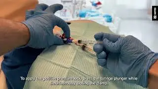iMEP Tips & Tricks 25: Positive pressure locking