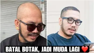 PROSES TANAM RAMBUT GUE DARI BOTAK SAMPAI HASILNYA. [Personal Vlog]