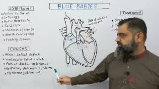 Blue baby syndrome English medium @prof.masoodfuzail #bluebabies #cyanosis #bluebabysyndrome
