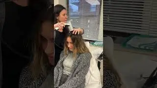 Alopecia Areata - Her Hair Story #hairloss #femalehairloss #shorts