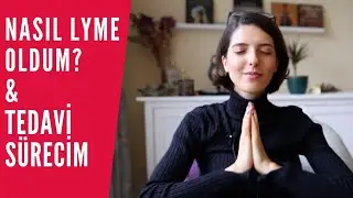 Justin Bieber'la ortak bir noktam varmış! Nasıl lyme oldum? 💊Tedavi sürecim & şimdi