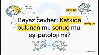 Alzheimer'ın Haritası Yeniden Çiziliyor: Beyaz Cevher Hasarı ve Tedavi Fırsatı!