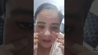 REMOVENDO  O ACIDO .DO PRIMEIRO DIA TRATAMENTO DE MANCHAS E MELASMAS .PARTE 1