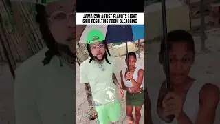 ЯМАЙСКИЙ ХУДОЖНИК ХВАСТАЕТСЯ ОТБЕЛИВАНИЕМ КОЖИ