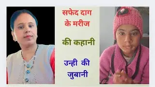 🥰💥 सफेद दाग  मे मिली बहतरीन रिकवरी 💞💓   सफेद दाग का इलाज  7088909017