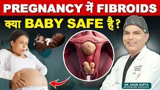 Fibroid in Pregnancy क्या ये SAFE है? | Fibroid का इलाज बिना सर्जरी | Fibroid in Uterus Treatment