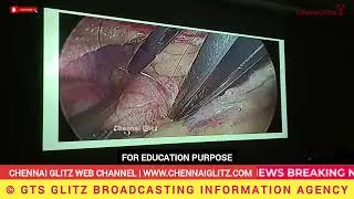 SIMS Hospitals Performs India&rsquo;s First Keyhole Removal of Rare Heart Tumour from the Left Ventricle