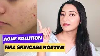 Complete Skincare Routine for Acne