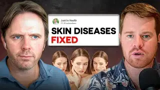 Psoriasis and Eczema FIXED by Removing This Hidden Trigger!