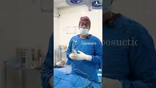 RF Treatment After Liposuction &ndash; Faster Recovery & Tighter Skin ✨