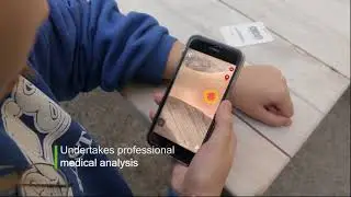 Bite Inspector