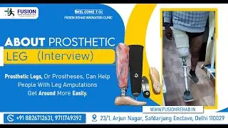 About Prosthetic Leg interview // Artificial Leg // #fusion #orthotics #artificialleg.