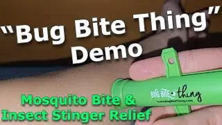 &ldquo;Bug Bite Thing&rdquo; Demo: Mosquito Bite & Insect Stinger Relief (Chemical-Free!)