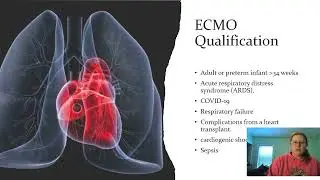 ECMO Presentation