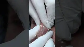 BARBER FACE AND NOSE OIL REMOVAL - MASSAGE - CRACKS #asmracmp #massage #barber #sleep #relax #masaj