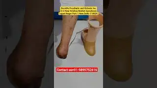 #ossur #artificiallimbcenter #artificiallimb #prostheticlimb #lowerlimb #symesprosthesis