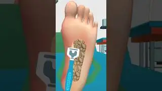 🦶 Foot Game play #vairl #game_play #video #foot_care