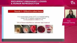 The potential of cell free fetal DNA for pregnancy loss