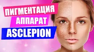 Как убрать пигментные пятна и омолодить лицо | Аппарат ASCLEPION MONOLITH