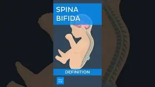 Spina bifida: Definition | Kenhub #spinabifida