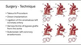 第12回 小児循環器病webinar 成人先天性心疾患の症例 シンシナティ小児病院フェロー 高城大治
