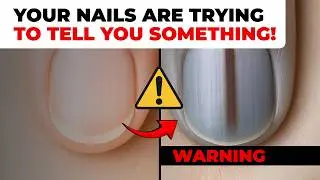 Is Your Nail Health Telling You Something? Discover the Hidden Signs