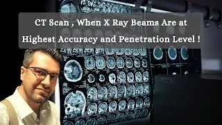 X Ray Imaging at Highest Accuracy and Penetration Level / CT Scan