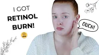 I Got Retinol Burn! What It Is, Causes, and Treatment
