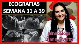 ECOGRAFIAS EMBARAZO SEMANA 31 A 39, POR GINECOLOGA DIANA ALVAREZ