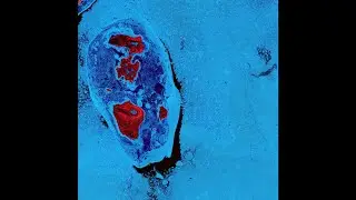 Sensek - Endoscope