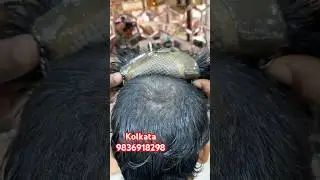 Clipping method self service.best hair patch centre in Kolkata.Taping method patch.glue method patch