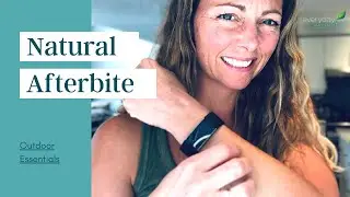 Natural &ldquo;after bite&rdquo; - combat itchy bug bites with this simple recipe