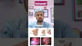 Microsurgical varicocelectomy for treatment of Varicocele. Whom to consult for Varicocele #urologist