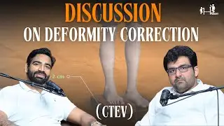 Discussion on Deformity Correction ( CTEV ) | Limb lengthening surgery in india | Height surgery