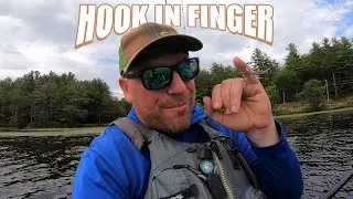 Big Treble Hook BURIED Into My Finger - Catching Fish With My Mola Gilla Crawler