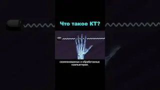 КТ - принцип работы и области применения #меднавигатор #кт #диагностика #медицина #здоровье