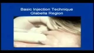 Aesthetic Evaluation of the Botulinum Toxin Type A