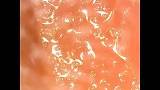 1000x Zoom of a shoe, tomato, pen, mobile display.