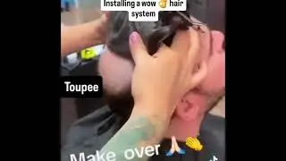 Como se pone el toupee?yo te ense&ntilde;o!  Installing a wow 👌 hair system ✔️